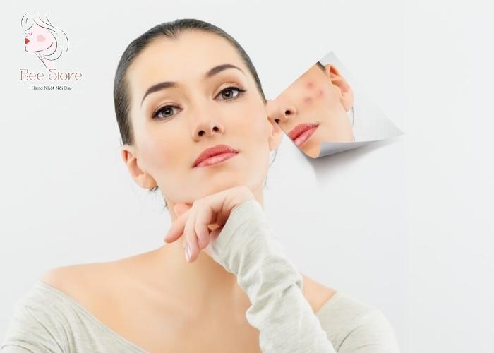 da dầu mụn có nên dùng kem chống nắng