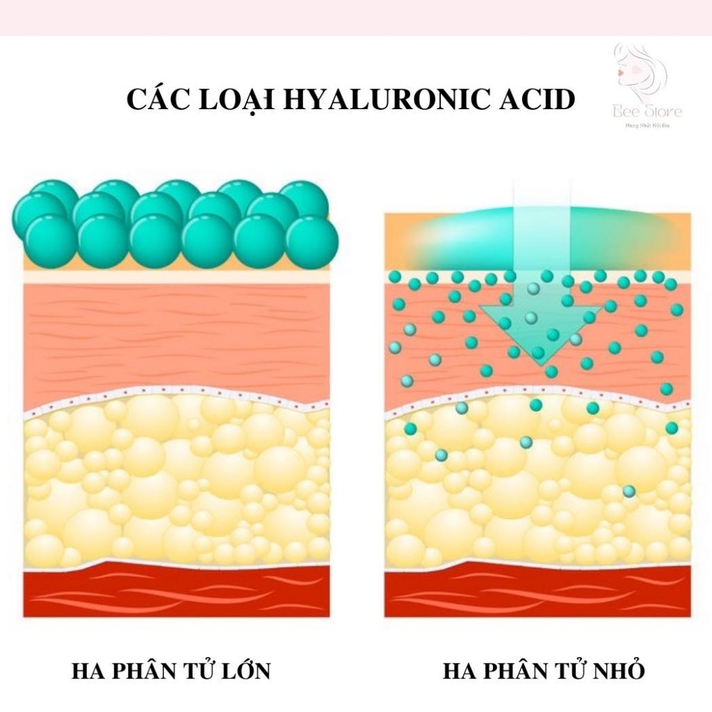 các loại hyaluronic acid