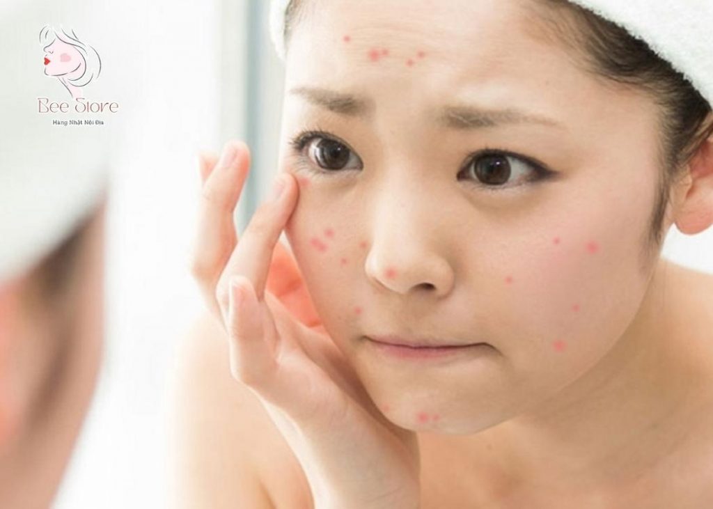 sờ tay nhiều sẽ làm mụn lan nhanh