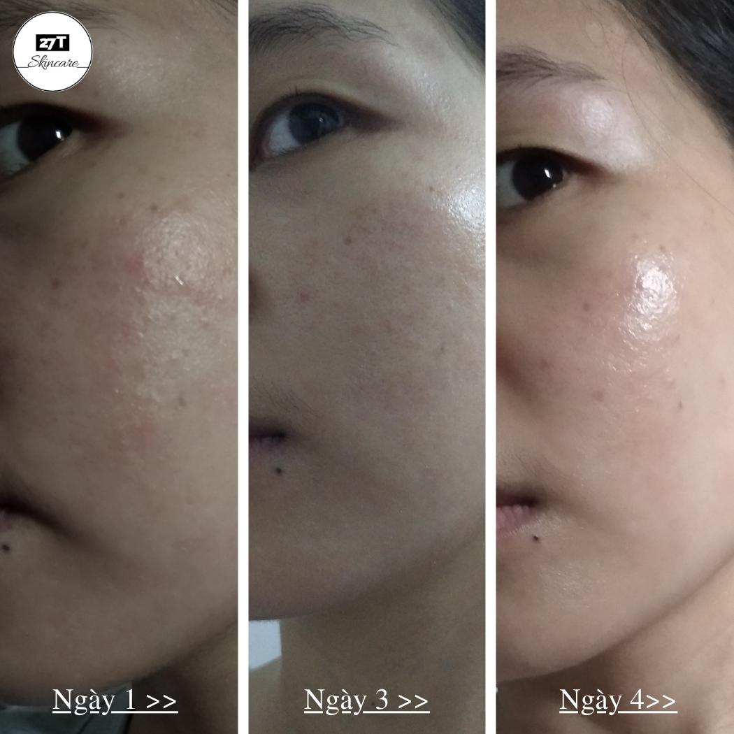 khả năng phục hồi da của b5